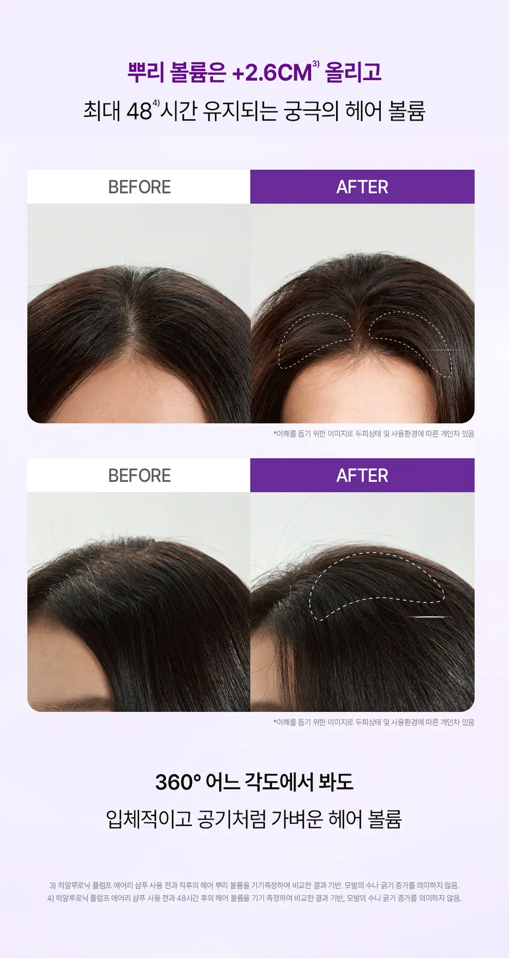 [+미니증정/수분볼륨UP]로레알파리 히알루론산 두피앰플샴푸 440ml 단품/기획(약산성) 상세페이지 17